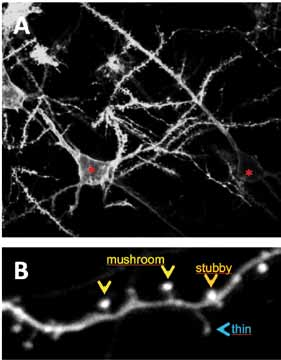 esempi-di-neuroni-della-corteccia-cerebrale-si-possono-distinguere-i-corpi-cellulari